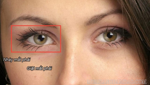Có những nguyên nhân nào dẫn đến tình trạng mắt phải nháy liên tục?