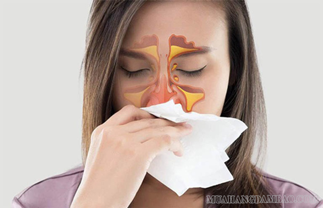 Hắt hơi quá nhiều có thể do bạn đã mắc căn bệnh viêm xoang