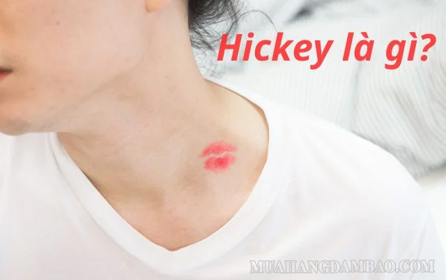 Dấu hickey được rất nhiều bạn trẻ yêu thích