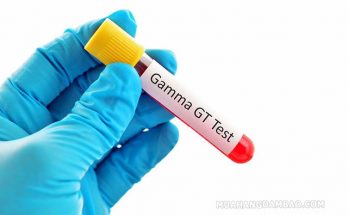 GGT là một loại enzyme có chủ yếu ở gan 