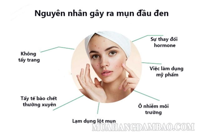 Có rất nhiều nguyên nhân dẫn đến trình trạng mụn đầu đen