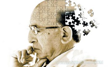 Bệnh Alzheimer là căn nguyên gây chứng giảm trí nhớ ở người già
